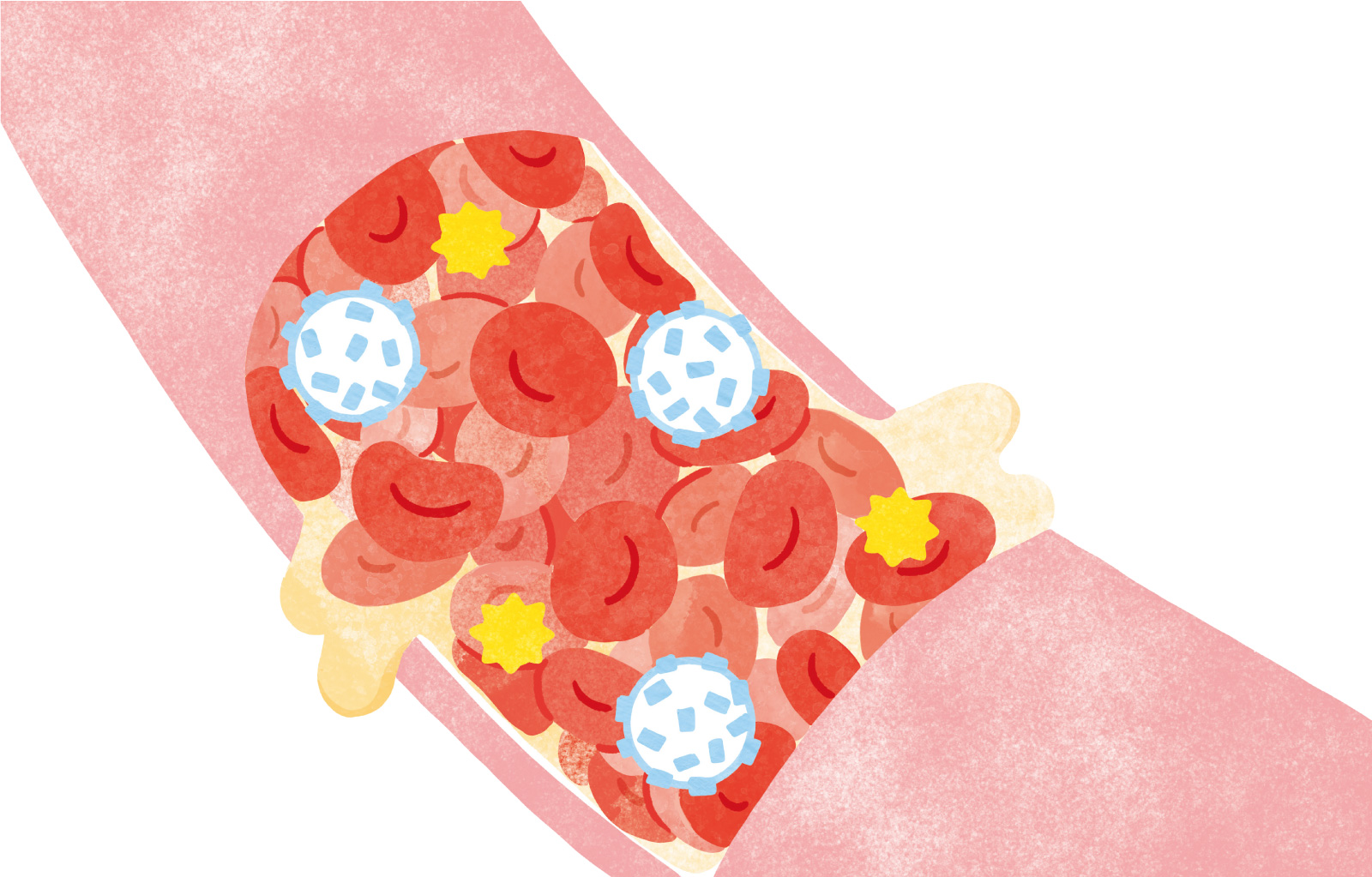 list_thumbnail057.jpg