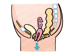 骨盤臓器脱のイラスト