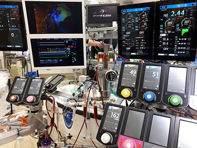 人工心肺および各種補助循環装置の運用業務