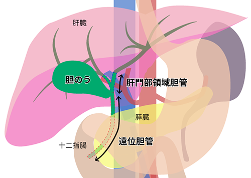 胆道